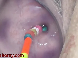 Uterus Penetration near Objects, Pumping Cervix Prolapse